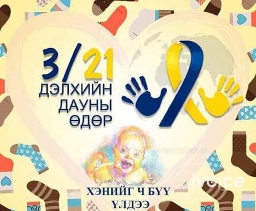 Өнөөдөр  “Дэлхийн дауны хам шинж өвчний эсрэг тэмцэх өдөр”